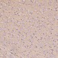 Anti-Glutamine Synthetase GLUL Rabbit Monoclonal Antibody